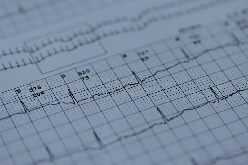 EKG-Ausdruck mit Herzkurven, Nahaufnahme